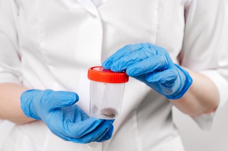 Stool Tests