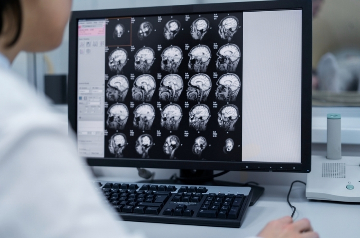 CT Brain