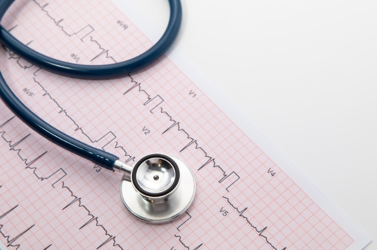 ECG